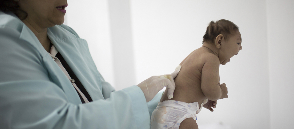 Eine Ärztin hält ein Baby, dessen Kopf verformt und zu klein ist.