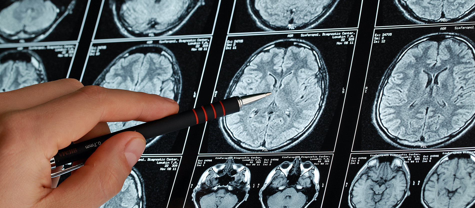 Braindrain im Vatikan