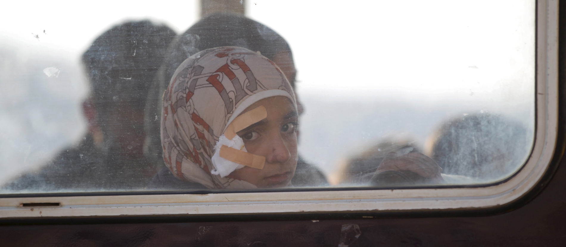 Ein verwundetes Syrisches Mädchen sitzt am Fenster in einem Bus mit Flüchtlingen.