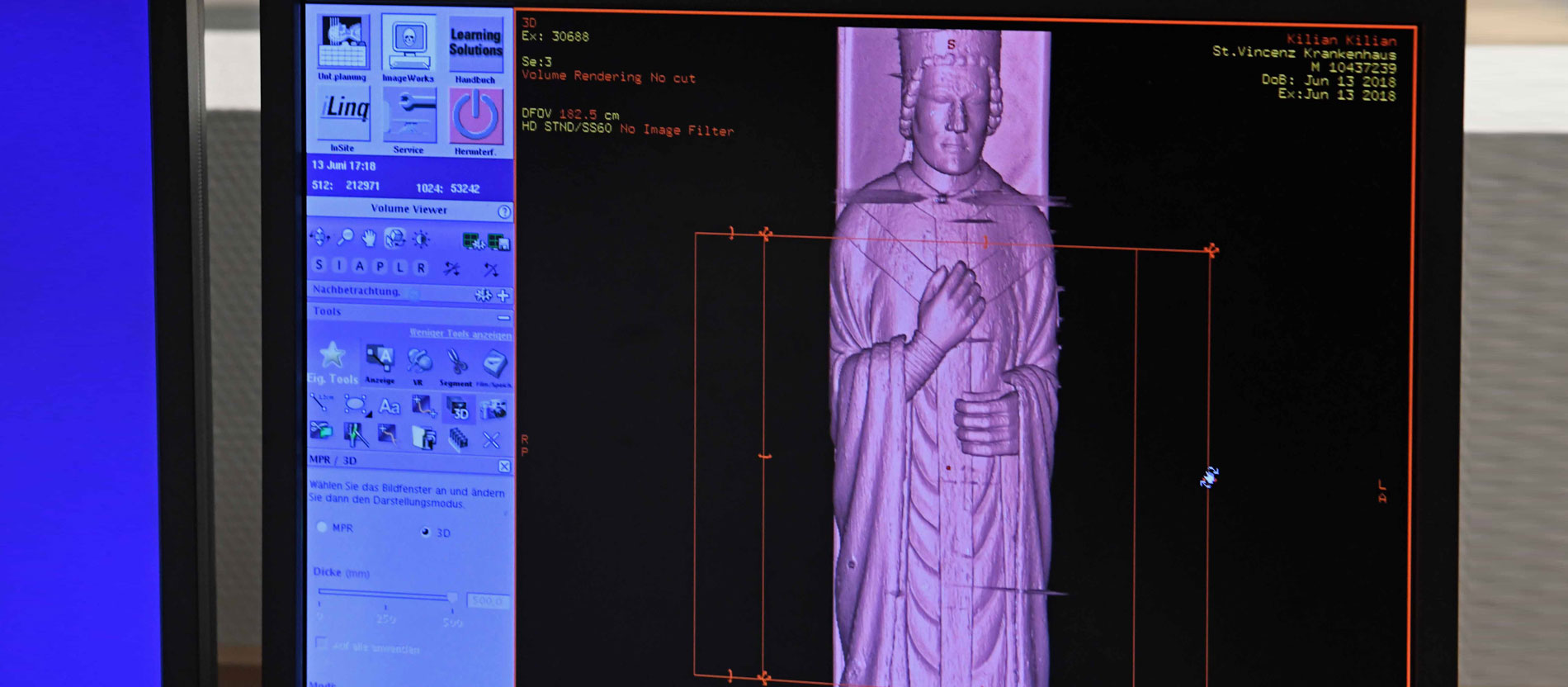 Hochauflösend zeigt der Computertomograph den Frankenapostel Kilian an.